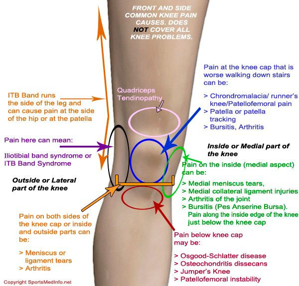 Dry needling trigger points around knee and hip joints improve function in OA