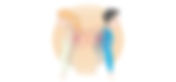 Does bad posture lead to chronic low back pain