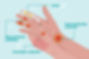 Could Chiropractic Care Alleviate Your Hand Pain?