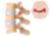 What is the Main Structure Behind 42% of Middle Back Pain?