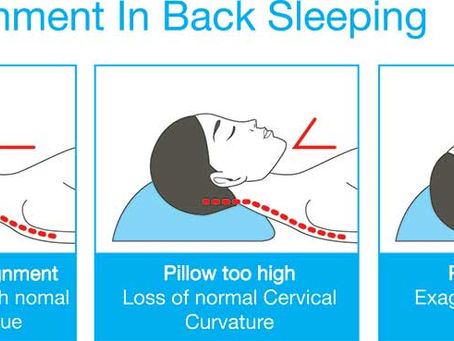 Sleep Positions to Alleviate Low Back Pain: Expert Recommendations