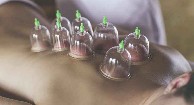 Cupping: The Physiological Response- How it can help