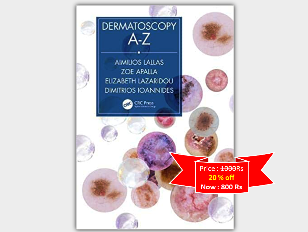 Dermatoscopy A-Z (1st Ed) Colored Glossy version