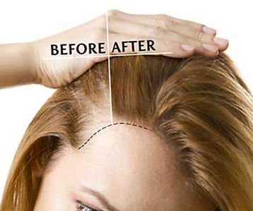 hair resoration.JPG