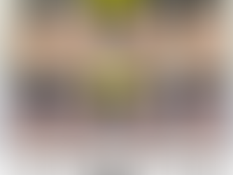 3D 돌출입수술 방법: 수술과 교정, 어떤 방법이 더 좋을까? 돌출입수술1년 전후비교