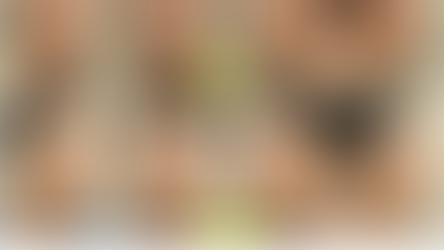 Double Jaw Surgery Recovery Time: A Surgeon’s 7-Week Timeline (Real Case Study)