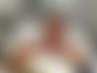 Bolsonaro passa por cirurgia para desobstrução intestinal e reconstrução da parede abdominal, diz hospital