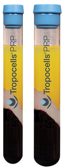 Tropocells PRP (both sizes).png