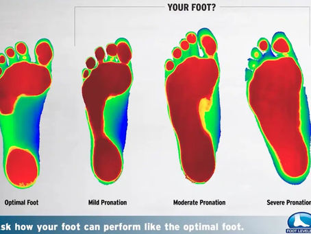 Why Footlevelers Custom Orthotics Are a Foundation for Your Health