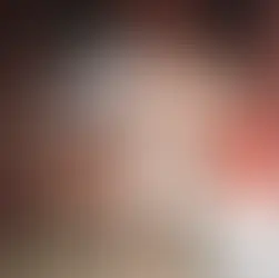 Hot Girls Have IBS: 10 Tips to Get Rid off Gut Pain and Discomfort in 2022