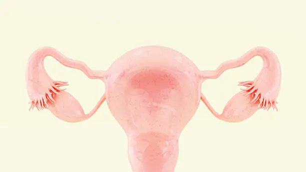 PCOS