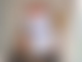 Viruela del mono: Minsa lanzó aplicativo “Qatipay” para rastreo y seguimiento de contactos de casos