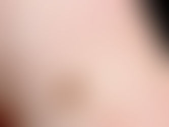 Reporta Chihuahua 43 muertes por rickettsiosis en 2025; la capital y Juárez concentran la mayoría de los casos