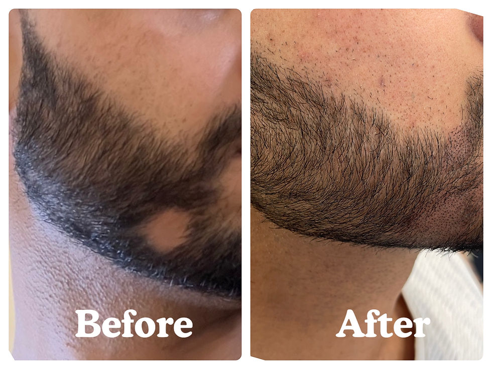 Beard SMP