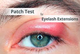eyelash lash allergic swollen sensitive vidalondon mugeek