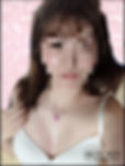 自體脂肪隆乳打敗漏斗胸