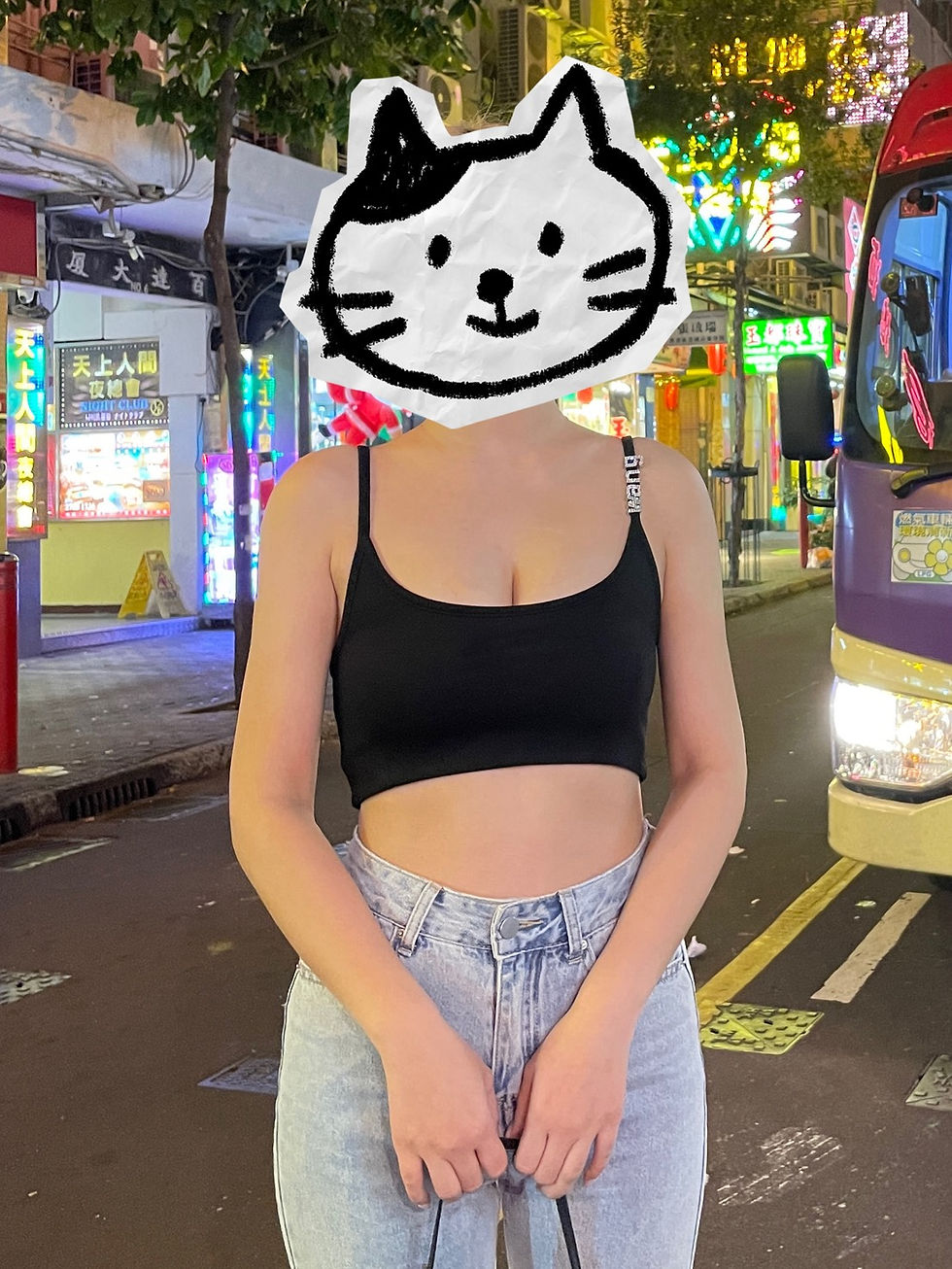 手臂抽脂術後
