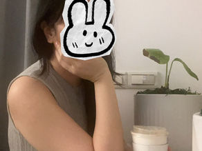 局部麻醉手臂抽脂