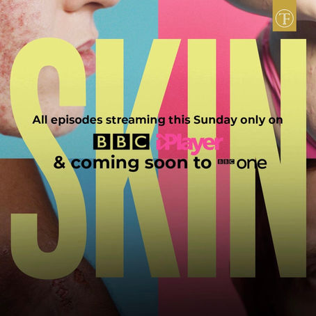 Skin on BBC iplayer