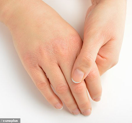 Shh! Anti-agers no one but you need know about: What’s the best way to soothe my dry hands?