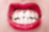 Smiley Piercing Detail with Snarling Woman's Mouth.jpg