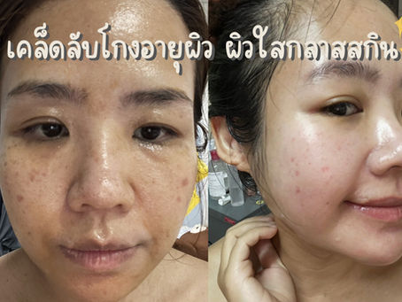 เคล็ดลับโกงอายุผิว ผิวใสกลาสสกิน