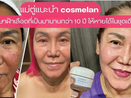 แม่ตู่แนะนำ Cosmelan รักษาฝ้าเลือดที่เป็นมานานกว่า 10 ปี ให้หายได้ในชุดเดียว