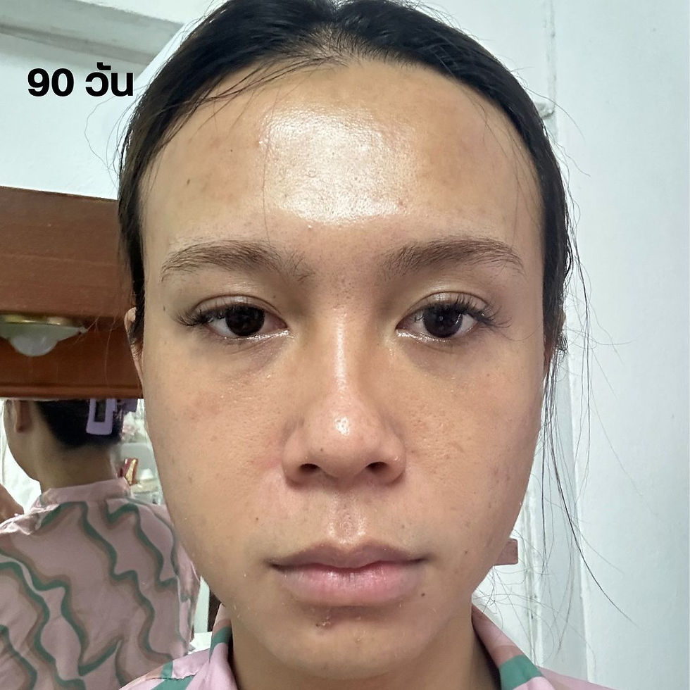 Glass skin