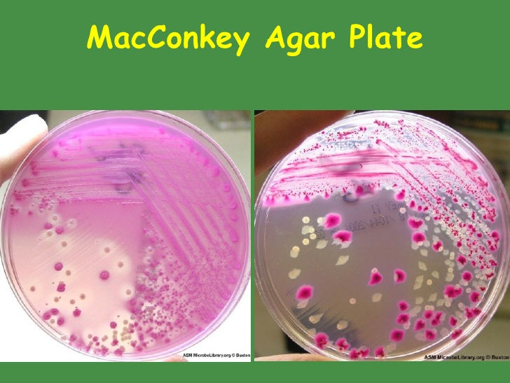 Urinary Tract Infections