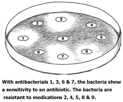 urine culture sensitivity diagram