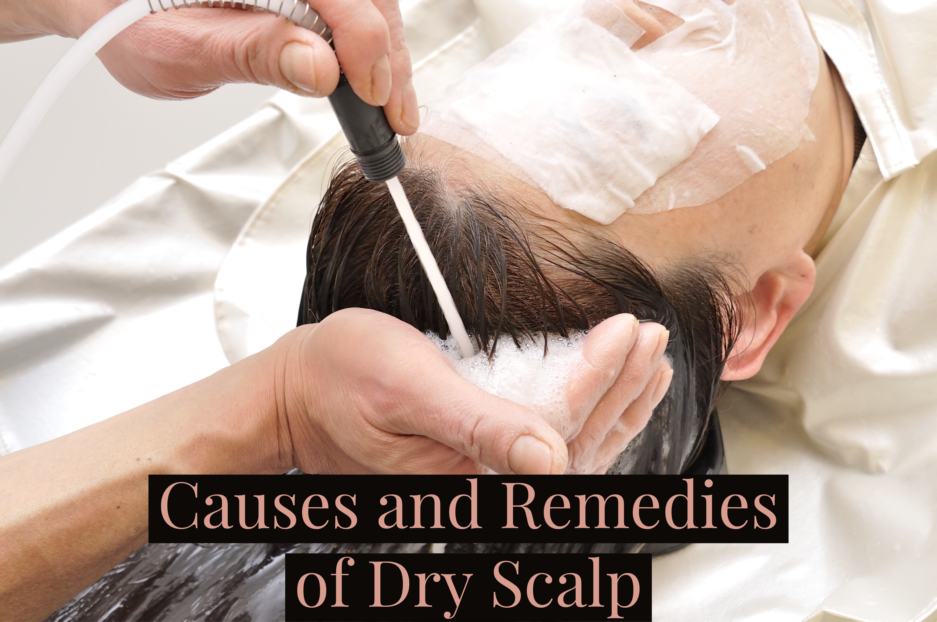 home remedies for itchy scalp home remedies for itchy scalp