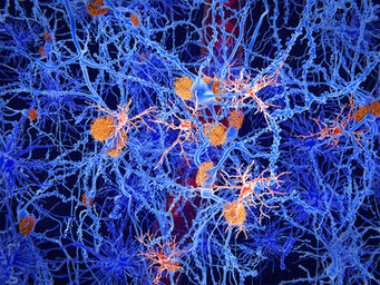 How Parkinson’s disease research is changing, and needs to: Notes from ADPD