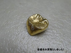 ★金歯★  金歯も売れます！結構な金額になるので捨てたら勿体ないです。