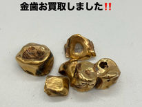 金歯買取⭐︎ご自宅で保管されている金歯をお買取します✨買取大吉安城桜井町店