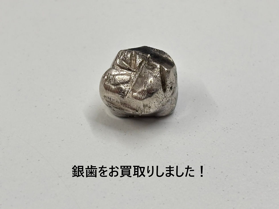 銀歯をお買取りしました！ 金歯・銀歯の買取は買取大吉ドミー若松店におまかせください！