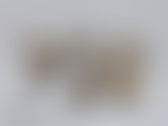 ★金歯★金歯をたくさんお持ちいただき、お買取しました！