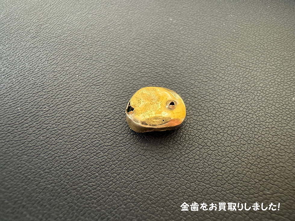 買取大吉安城桜井町店で買取した金歯
