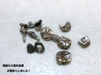 銀歯買取☆金歯や銀歯売るなら豊田市の買取大吉豊田店へ★