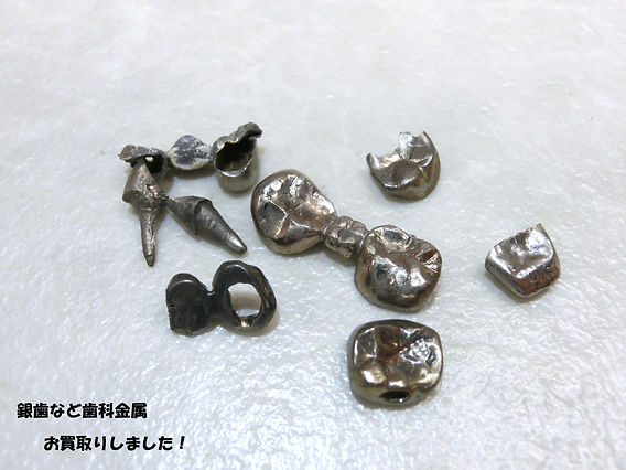 銀歯買取☆金歯や銀歯売るなら豊田市の買取大吉豊田店へ☆