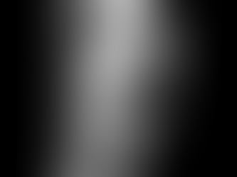 Osgood-Schlatter Disease