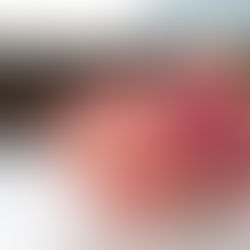 Artificial Organs: Future Savior of Many