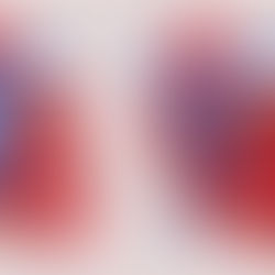 Dilated Cardiomyopathy