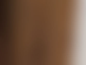 Look at these Hyphal Fragments (black areas).