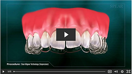 Invisible Braces.png