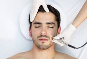 microdermoabrasion.jpg