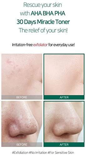 Miniature : Application du tonique SOME BY MI Miracle Toner – peau nette et éclatante