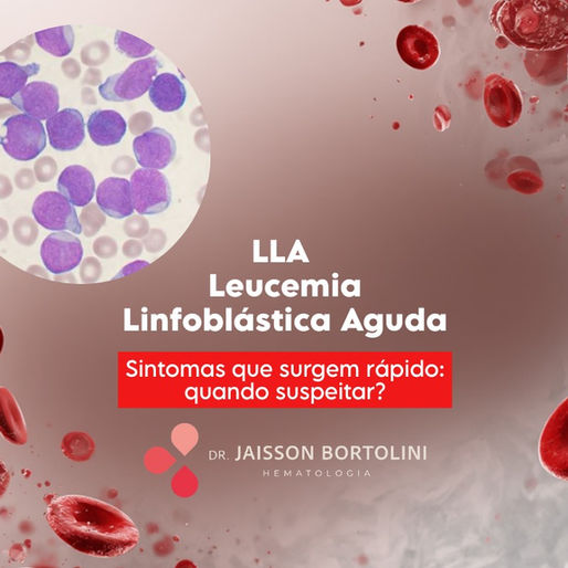 LLA (Leucemia Linfoblástica Aguda): sintomas que surgem rápido — quando suspeitar?