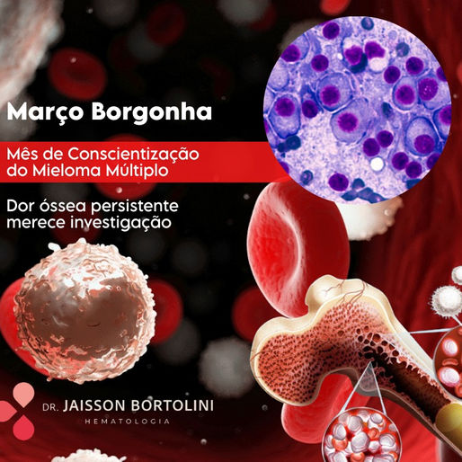 Mieloma Múltiplo: quando a dor óssea persistente merece investigação