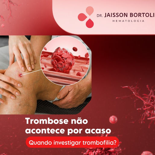 Trombose não acontece por acaso.