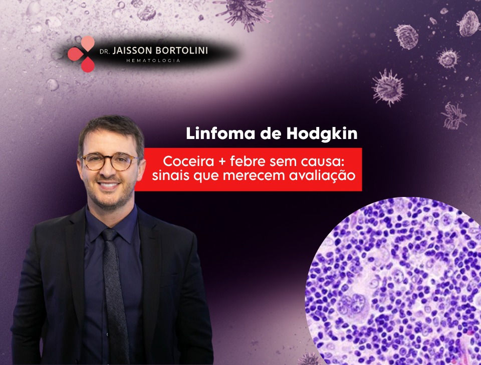 Linfoma de Hodgkin: quando coceira e febre sem causa merecem investigação